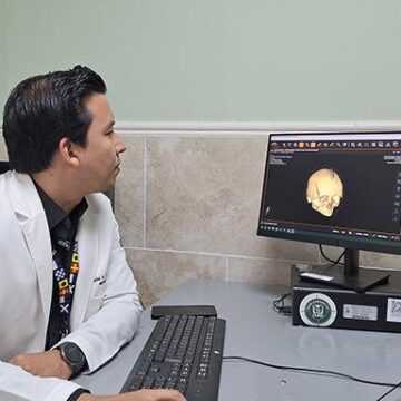 IMSS Veracruz Sur realiza exitosa cirugía de cráneo con malla de titanio a paciente con traumatismo