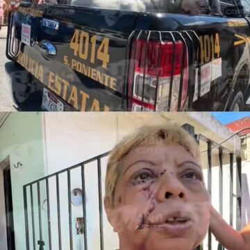 No serán sacrificadas los pitbull, que agredieron a adulta mayor y con discapacidad