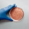 Brote de cyclospora ligado a lechuga se extiende en EU
