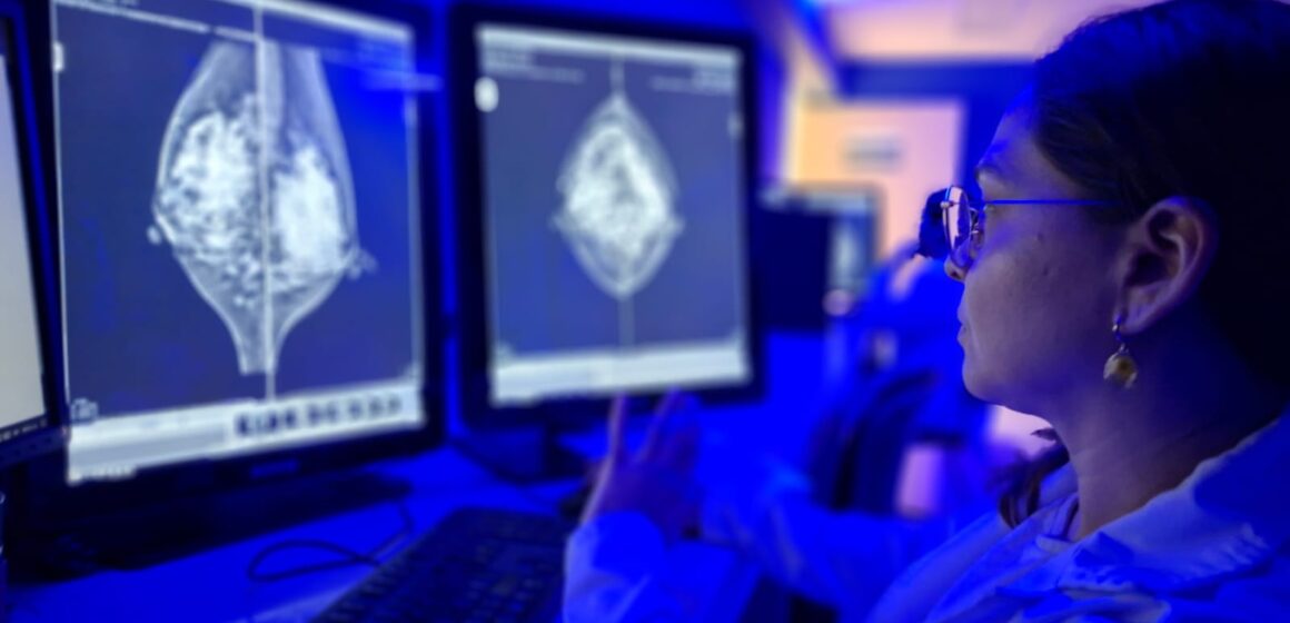 IMSS Yucatán orienta sobre autoexploración mamaria