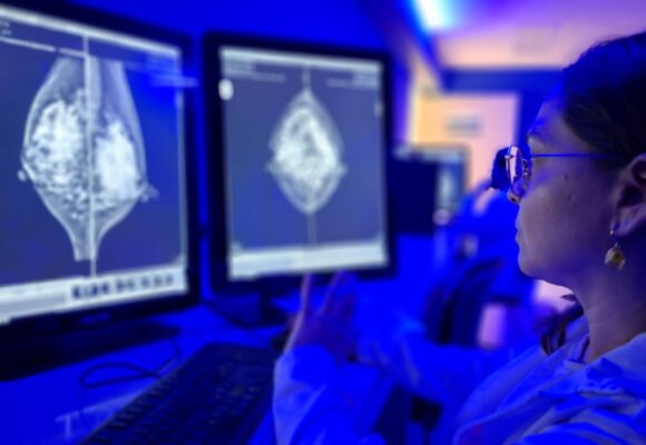 IMSS Yucatán orienta sobre autoexploración mamaria