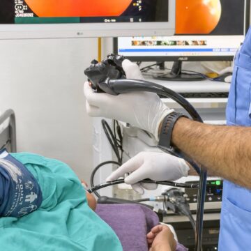 IMSS Yucatán realiza jornada de endoscopias en HGR No. 1