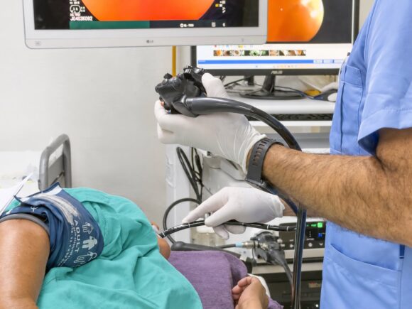 IMSS Yucatán realiza jornada de endoscopias en HGR No. 1